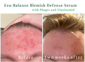 Eco-Balance Blemish Defence Serum with Phages and Niacinamide