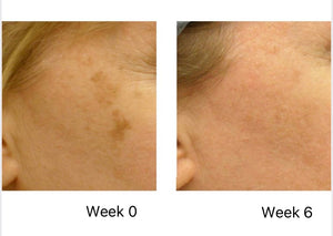 Intensive Brightening Serum with L-Ascorbic Acid, Ferulic Acid, and  Panthenol