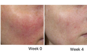 Luminous Balance Cream with Azelaic Acid and Panthenol